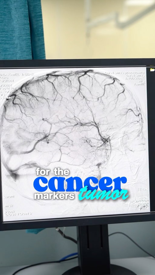 One number on your CBC may deserve more attention than you think.

Lymphocytes are part of the immune system responsible for identifying and fighting abnormal cells. Trends matter, especially during cancer treatment.
