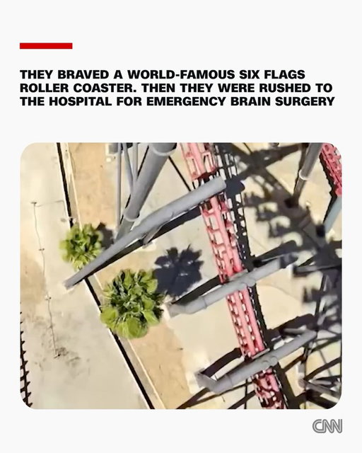 In the span of less than a week this July, surgeons at a Southern California hospital raced to save the lives of two women suffering from alarmingly similar brain hemorrhages.

The severe injuries were the kind doctors encounter in patients after high-speed collisions or other violent accidents that cause the brain to twist and slam inside one’s skull.

Neither woman, however, had been involved in a crash, fall or other such incident.

Instead, they had ridden an extreme roller coaster at Six Flags Magic Mountain, known as X2, which draws thrill-seekers from around the world with its rotating seats, near-vertical drops and unpredictable movements. It has long been the park’s marquee attraction — promoted as a “[rite] of passage for the ultimate daredevil.”

But behind the ride’s legendary reputation lies a troubling record of serious injuries, a CNN investigation has found. 

Six Flags closed the roller coaster the evening of July 12, according to a spokesperson. This was nearly a full day after the latest injury there, and park officials have remained silent about what necessitated the closure.

The California Division of Occupational Safety and Health, which oversees amusement park ride operations, did not respond to questions about the history of brain injuries allegedly associated with X2 and did not say how it has deemed it safe to reopen after past incidents. It would only say an inspection remains ongoing.

Six Flags also declined to answer detailed questions from CNN, including questions about why X2 remained operational in the wake of the first July injury, saying the only information it is sharing is that “the ride remains closed at this time.”

See what the CNN investigation uncovered at the link in our bio.

📷: Courtesy Pamela Guillen