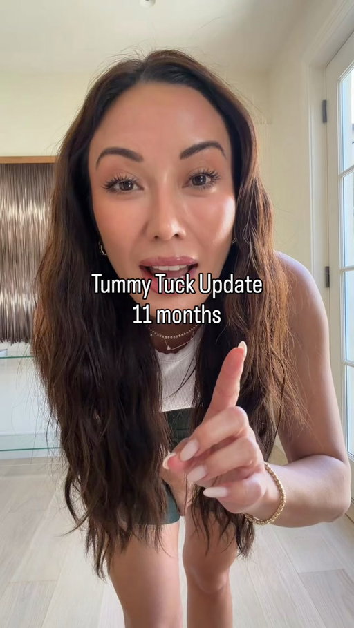Tummy tuck update! Can’t believe it has been almost a year since I went to @doctorkeyes for my surgery. Noting I see my trainer @soonyaroygodfrey three times a week, get lymphatic drainage massage with @bwbyadriana, and have had fraxel treatments at @skincarebyamyp all here in Miami.