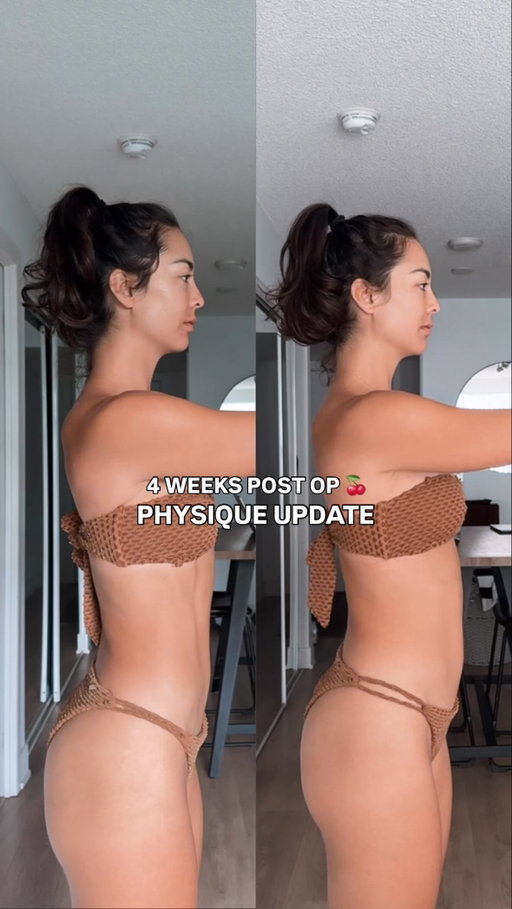 Little physique update after 4 weeks off post-op 🍒

🚨 Comment JOIN for a FREE week to the plan that’s going to me back on track after my surgery!

A lot of you commented that you wouldn’t want to get an augmentation because taking 4-6 weeks off working out would be too hard for you.

But to be honest, I went into it excited to have a break.

After training and filming nonstop for over a year, physically and mentally I was looking forward to the time off! 🎉 
 I didn’t really make any changes to my diet, I got an extra hour of sleep every night, and I walked 15 to 20 K steps a day (30 min on the treadmill in the AM, and a 30-60 min walk in the afternoon).

While I gained a littleee weight, I truly don’t mind at all. Instead, what I’m MOST excited about is getting my strength and endurance back up and doing it in a smart and intentional way 🫶🏼

If you’re looking for something to help you get back on track, dial in and focus on your training, come join me for a free week on my platform.

💥 Comment JOIN below and I’ll send you your link to get started!