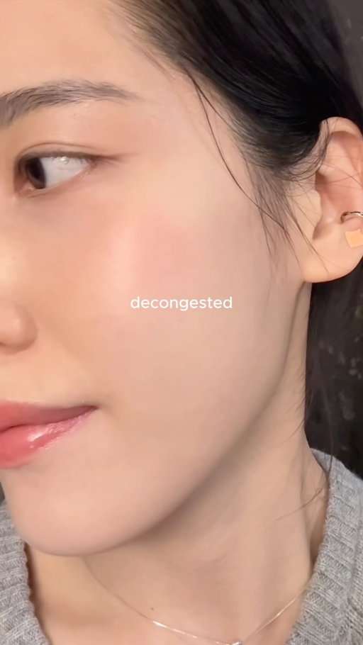 Retinoids+azelaic acid with barrier care on other days

#koreanskincare #skintok #skincareroutine #cloggedpores #congestedskin