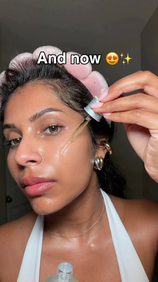The power of Azelaic Acid is unmatched for my brown skin girlies 💖 comment “Anua” and I will DM you the product 🫶🏾 @anua_global AD

#melasma #anuaazelaicacidserum #azelaicacid #hyperpigmentation #glassskin