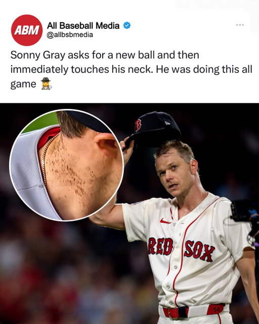 Sonny Gray had MLB fans playing detective last night 👀🕵️‍♂️

Fans noticed Gray repeatedly touching a discolored spot on the back of his neck during Game 2 against the Yankees — including after getting a new baseball — which quickly sparked “sticky stuff” accusations online. There’s been no confirmed evidence that Gray was using an illegal substance, but the clips definitely had people asking questions. 😭⚾️ 

Gray finished with 4.2 IP, 6 H, 2 ER, 0 BB and 5 K before Boston ultimately lost 9-2. 

What do y’all think was going on here? 👀

#mlb #mlbbaseball #pitcher #baseball #baseballisback
