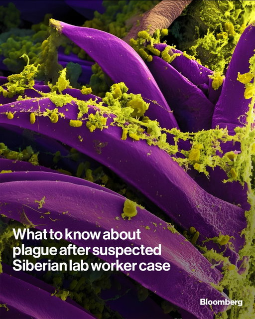 Plague killed tens of millions of people in past pandemics, but today it’s rare in humans and usually treatable with antibiotics. A Russian lab worker’s unexplained death has put the disease back in focus.

Tap the link in the bio for more on what to know about pneumonic plague and the risks it poses.

📷: NIH/NAID/IMAGE.FR/BSIP/Universal Images Group/Getty Images