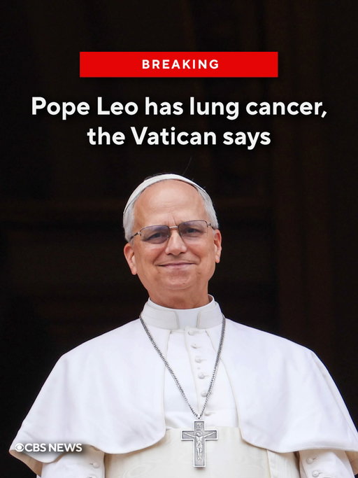 BREAKING: Pope Leo XIV’s surgery confirmed that he has lung cancer and he had the lower lobe of his right lung removed, the Vatican said Tuesday.

The tests confirmed a diagnosis of lung adenocarcinoma, the Vatican said in a medical bulletin after the surgery. It said the diagnosis had been suspected by preoperative tests and was confirmed during surgery.