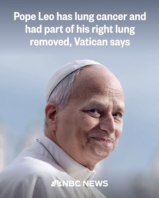 Pope Leo XIV was diagnosed with lung cancer Tuesday and had part of his right lung removed, the Vatican announced.

The news came after the seat of the Roman Catholic Church first reported that the Pope’s surgery to remove a lung nodule was completed “successfully, on schedule and as planned.”

The 71-year-old Leo returned to his room after the surgery at Rome’s Gemelli hospital, according to a statement from the Vatican spokesman, who promised further information at a later time.

Read more at the link in bio.