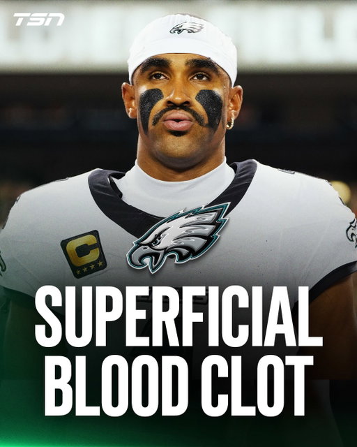 The Eagles will be without Jalen Hurts for the foreseeable future after he was diagnosed with a superficial blood clot in his calf, the team confirmed.

Hurts will miss Philadelphia’s matchup with Carolina on Sunday, and backup QB Tanner McKee is expected to start in his place, per @rapsheet