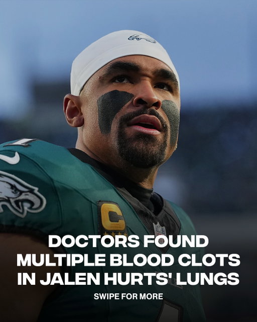 Jalen Hurts will miss the rest of the NFL season after being diagnosed with multiple blood clots in his lungs.
ㅤ
The Philadelphia Eagles quarterback initially discovered a clot in his calf before further testing revealed deep vein thrombosis and pulmonary emboli in both lungs. Hurts is clinically stable and expected to make a full recovery, with treatment expected to take at least three months.
ㅤ
📷 Getty Images