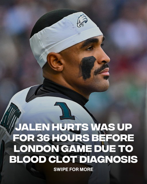 Jalen Hurts is a WARRIOR 🐐
ㅤ
Jalen Hurts reportedly stayed awake for 36 hours before the Eagles’ game in London after doctors discovered a blood clot in his calf. Doctors initially advised the Eagles quarterback not to sleep as a precaution. Further testing later revealed blood clots in both lungs, and Hurts is expected to miss the remainder of the 2026 season while undergoing treatment.
ㅤ
📷 Getty Images