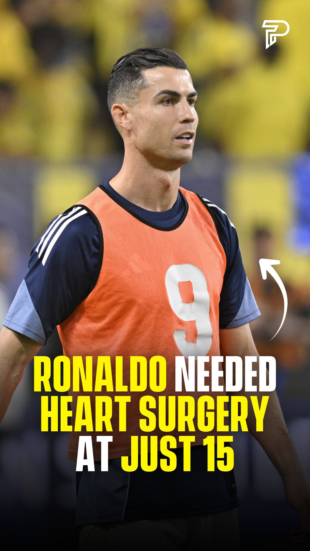 At 15, Cristiano Ronaldo was told a heart condition called tachycardia could end his career before it started. He had surgery the next morning and was back training within days.

Three years later, an 18 year old from Madeira tore Manchester United apart in a friendly. Sir Alex Ferguson signed him before the final whistle for £12 million, a record fee for a teenager at the time.

Five Ballon d’Ors, five Champions League titles and over 900 career goals later, he’s heading into his sixth World Cup this summer at 41. The kid who nearly lost everything before it began is still not done.

#hosted #pubity #viral