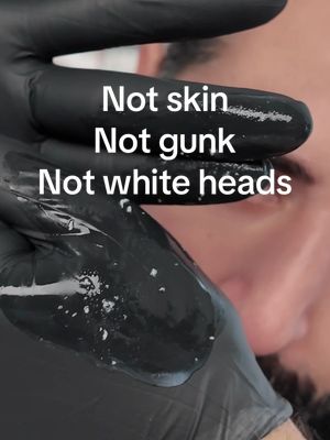 Replying to @Lupe  it was just a visual aid 🥲 I feel like gommage peeling gels will never get the recognition they deserve because people make them look so gimmicky 🥲 #skincare #skincaretips 