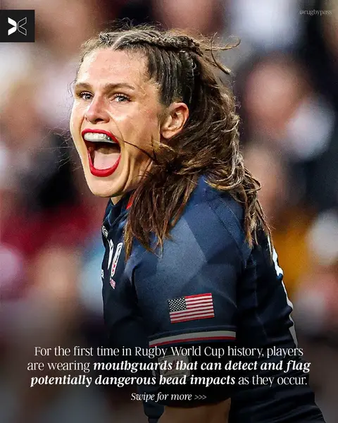 The future of rugby is here and it’s prioritizing player safety 👏 #rwc2025 #rugby #rugbyworldcup #mouthguard #womenssports 