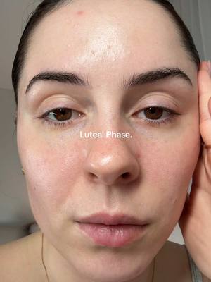 I find it so interesting how our face, skin can change during - Luteal Phase, Menstruation, Follicular phase & ovulation.