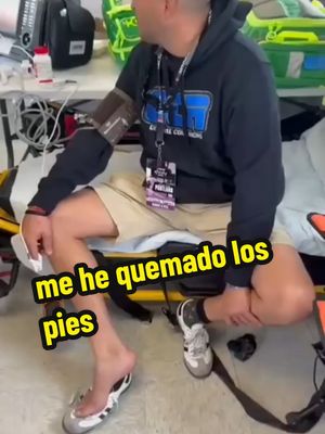 Ayer acabé en el hospital... todo el pie quemado.. cosas de las carreras.  #motorsports #españolesporelmundo #nascar #stockcar 