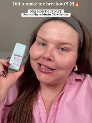 @Amanda Frisch  Shiny botox forehead unlocked ✅ Shoutout to queen @Shelby Ann and y’all for putting me on!!  #affordablemakeup #byoma #acne #makeupreview    @byoma 