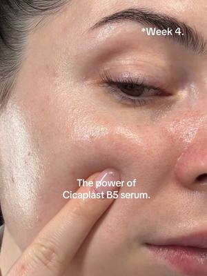 La Roche Posay Cicaplast serum is the best barrier supporting serum that always fixes 99% of my concerns.  @La Roche-Posay 