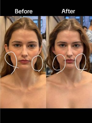 Replying to @leoniebur3 here’s a bit more of a run down on everything ear seeding that @AVA showed me and a better before and after of my face. Based in traditional Chinese medicine but also popular in Korea it helps with inflammation and tension in the body by targeting acupressure points in the ear. These are from @byAVA #earseeds #koreanbeautytips #depuffwithme #acupressure 