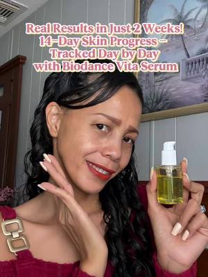 Real Results in Just 2 Weeks! 14-Day Skin Progress - Tracked Day by Day with Biodance Vita Serum @Biodance Store US  ✨ https://amzn.to/3VrP9B9 ✨link on my bio  #Biodance #VitaSerum #darkspots #niacinamide #skincare