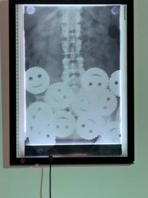 Uh Oh. Come back tomorrow at 10am ET to see what the diagnosis is. @Spirit Halloween 