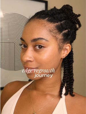 Hair thinning is something I've struggled with for years, but I'm finally taking consistent steps to restore my hairline ✨ #VegamourPartner  #vegamourchallenge and Dermaroller to rebalance my scalp and support a healthy growth cycle.  Lightweight, effective, and easy to add into my routine. Excited to share my progress with you all! #vegamourpartner #vegamourchallenge @sephora 