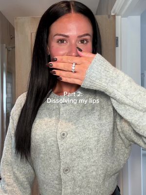 Part 2 is finally here, sorry for the delay 🥹 sooo happy with them, thank you @Grand Aesthetics 🤍🤍  #lipdissolving #lipdissolvingbeforeandafter 