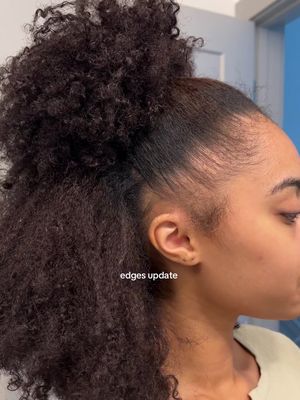 im seeing alot of improvement in my hairline :)) i still have like 2 bald spots but my edges are getting alot thicker to where its basically just growing over the bald part  what i have been doing ⬇️  limiting tight hairstyles is the biggest thing (tight buns, braids)  dermarolling for about 2 minutes once a week then following up with my hair serum  hair serums i have been using is @VEGAMOUR advanced serum & @CÉCRED edge drops & massage these in for ab 3-5 mins i’ve been keeping a solid routine to improve my hairline for about 2 weeks, i cant wait to see more progress ✨ #tractionalopecia 