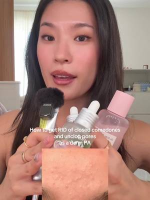 Maximizing your skincare by pairing active ingredients effectively :) @anua_global @Celimax US @Glow Recipe  #anuapartner #acne #skintexture #whiteheads #cloggedpores 