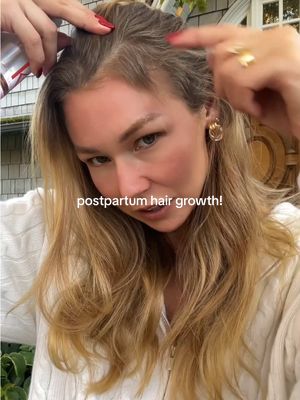 A few weeks ago, I shared that I started my @Kérastase Genesis journey and WOW the results are more amazing than I expected. I’ve been massaging this serum into my scalp daily and the hair growth is wild!! 🍂✨ #Kerastase #KerastasePartner