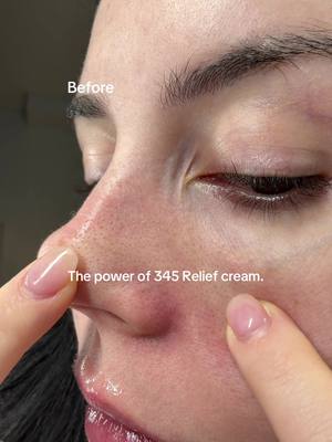 The power of 345 Relief cream. Why is it amazing? It contains Ceramides, Niacinamide ( not reactive ) & beta-Glucan with more incredible barrier supporting ingredients that create the perfect cream to layer over a serum 👏🏻  Product: @Dr.Althea US 345 Relief cream Draltheapartner 