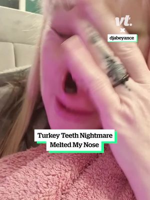 She's using her experience to help warn others of the potential dangers ❤️  (📹 @Abeyance dj 🎵)  #turkeyteeth #nose #awareness #fyp 