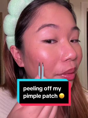 im back with more pimple patch peels 😈 #acne #skincare #pimplepatch #acneskincare @The INKEY List 