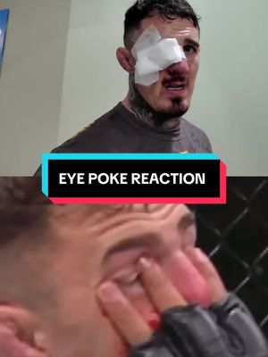 Life after an eye poke at UFC 321 #fyp #UFC #viral #tomaspinall 
