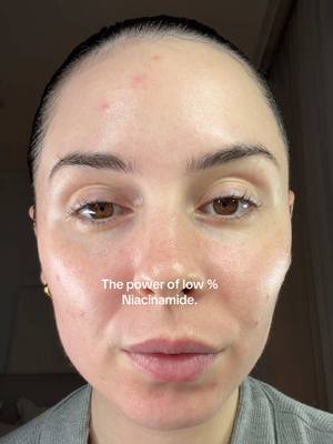 The AXIS-Y Dark Spot Correcting Glow Serum is powered by niacinamide to visibly fade dark spots and even out skin tone!  Infused with plant-derived squalane, it locks in hydration!  Perfect for all skin types, especially acne-prone or sensitive skin. 1000% you need to give this a try 👏🏻 @AXIS-Y axis-Ypartner.