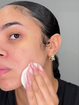 Some much needed TLC 🥺 What do you do when your face breaks out?