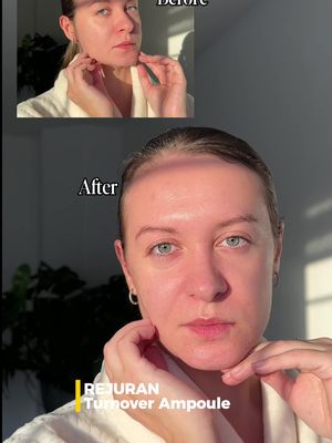 Rejuran turnover Ampoule #GlowwithKris #rejuran #turnoverampoule #pdrn #koreanskincare