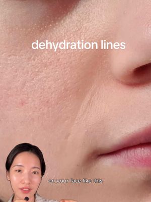 Dehydration lines can be confused as wrinkles but they’re made due to lack of moisture. They can appear on any skin type, especially to those who are prone to dry dehydrated skin, but tackling them might be easier and simpler than you think. Product in collaboration with:  Reju 5000 cream from Dr.althea #pdrn #egf #kpharmacy #koreanpharmacy #koreanskincare 
