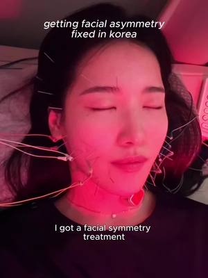 facial asymmetry correction i got at Korean medicine clinic 🔖clinic is @duna  Comment down for information❤️ #asymmetry #kbeauty #facesymmetry #asymmetricalface #koreanskincare 
