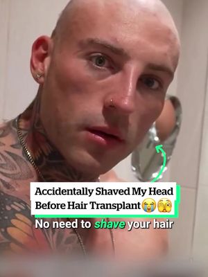 Fingers crossed that wasn't a costly mistake... 😬 (📹 @GEO | ONLINE COACH 🇬🇧🇦🇪)  #hair #haircut #fail #hairtransplant #fyp 