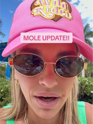 A mole update…  #imaceleb #fyp #explorepage 