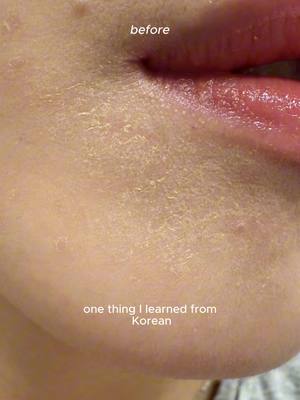 Patchy dry skin base makeup tips from Korean makeup artists in collab with @SKIN1004 US  🔖Product name: Skin1004- Madagascar centella ampoule Madagascar centella quick calming pad Madagascar centella cream #koreanskincare #skinprep #centella #makeuptip #skin1004