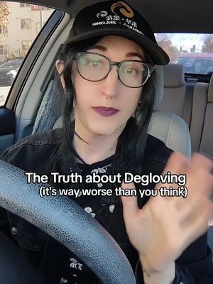 I was degloved in 12 BK (before kirk) and this is my story. I have been silent on my degloving for far too long. #gloving #degloved #scarystory 