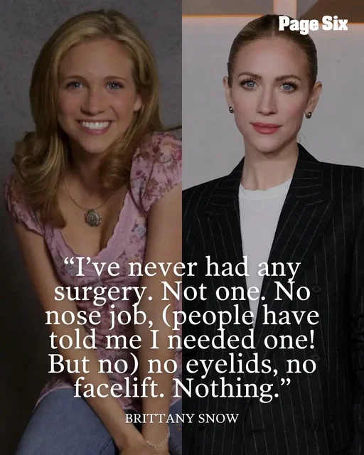 Brittany Snow set the record straight on plastic surgery rumors after Biobeauty founder Molly Bailey shared a before-and-after video of the “Hunting Wives” star on Instagram, claiming she had used injectables, fillers and “a bit more than Botox” to enhance her features. 🔍  📸: WireImage, Getty, 🎤: comments via baileysboujee/Instagram