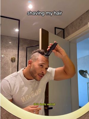 bald anderson 😭 #hair #turkey🇹🇷 #transformation #bald 