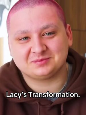 My Transformation😳 #fyp #viral #lacy #GlowUp #transformation 