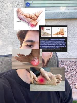 Overuse leads to this unknown problem plaguing workers everywhere 🦶 #plantarfasciitis #footpain #insoles 