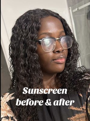 Sunscreen won’t magically clear acne, but it does protect your skin barrier and prevent dark spots from getting worse. This SPF 50 sun essence from @numbuzin protects against UVA & UVB rays while helping hyperpigmentation fade over time by shielding your skin from further sun damage. 🧴 Absorbs in seconds 🧴 Lightweight & non-greasy 🧴 Sits beautifully under makeup 🧴 Feels breathable on acne-prone skin #gifted #sunscreen #skincare #hyperpigmentation #fyp 