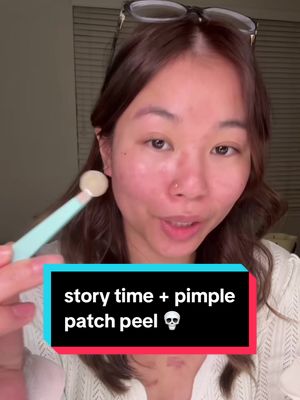Replying to @nattywatty my hairstylist almost peeled off my pimple patch 💀 #acne #pimplepatch #skincare @PeaceOutSkincare 