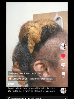major sale alert! #sale #shop #ad #hair #hairgrowth 