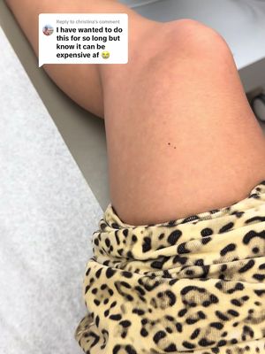 Replying to @christina IMO, so worth the investment in your health! 🫶🏽 #skincan #skincantoronto #skincancerawareness 