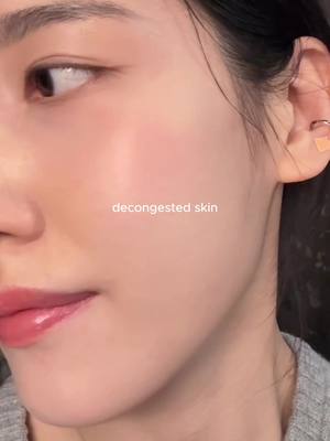Tips: 1️⃣ Speed up cell turnover Use something that pushes them out. Exfoliants like retinoids or BHAs help speed up cell turnover.  Consistency matters more than product name when it comes to retinoids → start slow (1–2x a week with lower strength is crucial) 2️⃣ Remove the causing products Especially check your moisturizers, makeup first.  I switch to minimal ingredient lists, and fungal-acne-safe products are good too. 3️⃣ Double cleanse at night Sunscreen + base makeup residue can trap comedones. Oil cleanse first, then follow with a gentle water-based cleanser. 4️⃣ Protect your skin barrier Congestion never thrive in a healthy skin environment. Don’t overdo exfoliation— use barrier-friendly products on off days. 5️⃣ Hydration matters more than you think Dehydrated skin overproduces oil. Light, watery hydration helps prevent new bumps. Hope it helps! #texturedskin #closedcomedones #cloggedpores #skintexture #skintok 